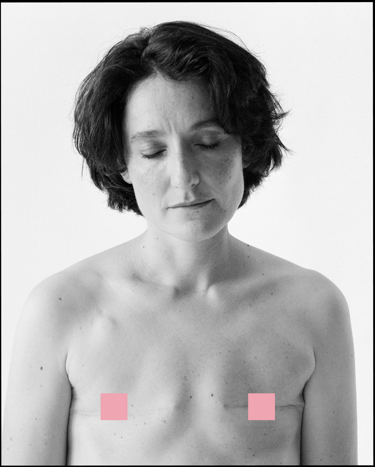 Portrait de Lucie après sa mastectomie